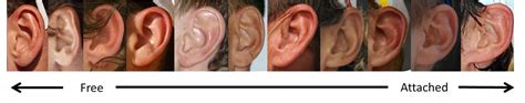 Attached Earlobes - Human Genetics Myths