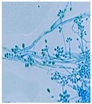 Sporothrix - Phylogeny, Habitat, Dangers and Treatment