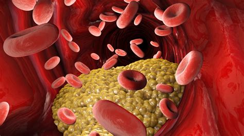 The Importance of Triglycerides - Pulse Cardiology