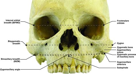 Ancestral Variations in the Shape and Size of the Zygoma - Oettlé - 2017 - The Anatomical Record ...