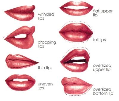 Types of lip fillers - Mapp Injectables