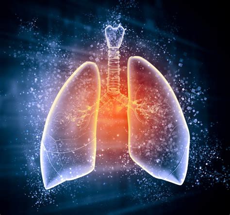 Acute Respiratory Distress Syndrome (ARDS) | ESICM Academy