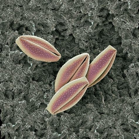 Lily Pollen Grains Photograph by Martin Oeggerli/science Photo Library - Fine Art America