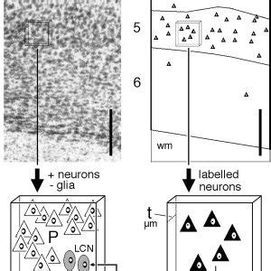 Projections to dorsal striatum (DS), ventral striatum (VS), and... | Download Scientific Diagram