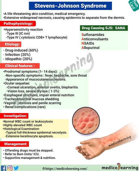 Medicolearning Steven Johnson Syndrome flash card | Steven johnson syndrome, Medical radiography ...