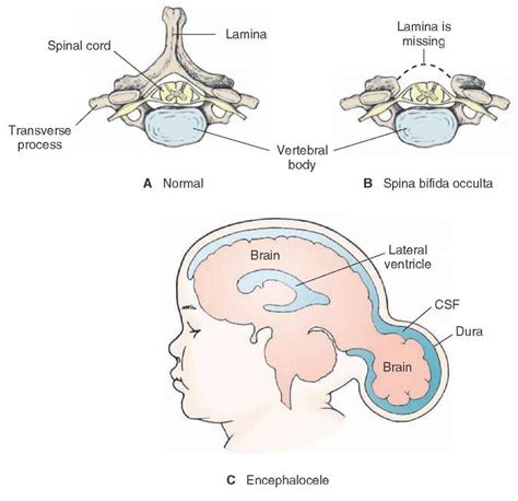 Development of the Nervous System (Gross Anatomy of the Brain) Part 3 | Nervous system, Neonatal ...