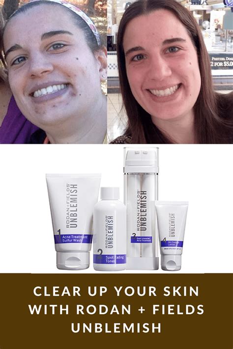 Rodan + Fields UNBLEMISH - A Regimen to Control Your Acne