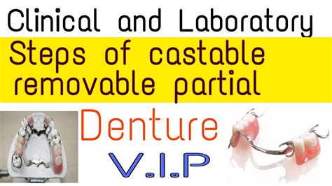 CLINICAL AND LABORATORY STEPS OF MAKING CAST PARTIAL DENTURE - YouTube