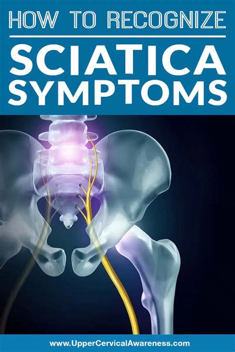 How to Recognize Sciatica Symptoms - Upper Cervical Awareness