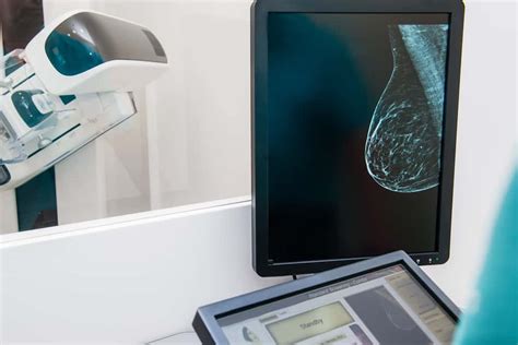 Mammogram Procedure: 7 Frequently Asked Questions, Answered