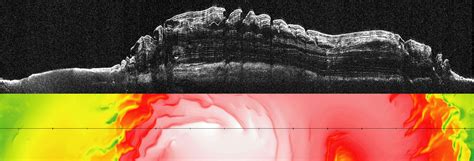 What Lies Below a Martian Ice Cap – NASA Mars Exploration