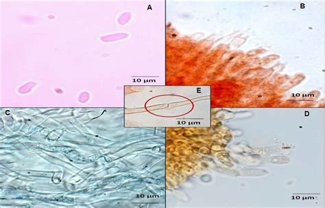 Light microscope photographs A. Basidiospores, B. Basidia, C. Pileus... | Download Scientific ...