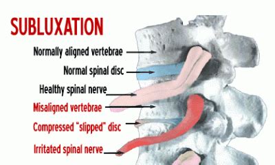 Silent Signs of Subluxation In Infants – Health First Chiropractic Richmond & Glen Allen VA