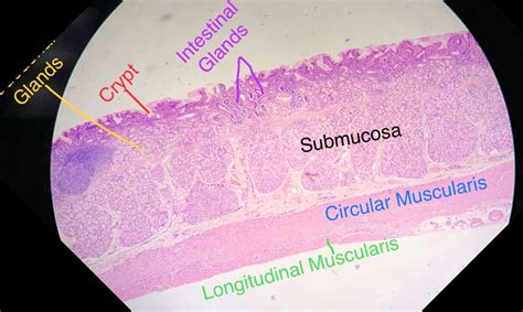 Duodenum Histology.