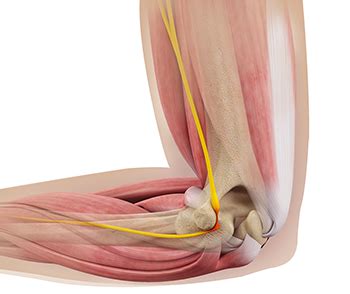 Ulnar Nerve Release Surgeon Chandler, AZ | Casa Grande | Hip Fracture Mesa, Queen Creek