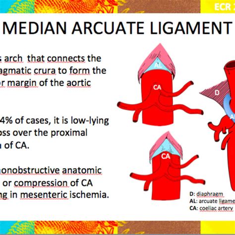 Arcuate Ligament