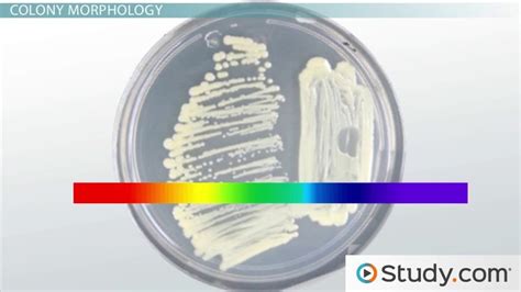 Bacterial Colony & Colony Morphology | Characteristics & Examples - Lesson | Study.com