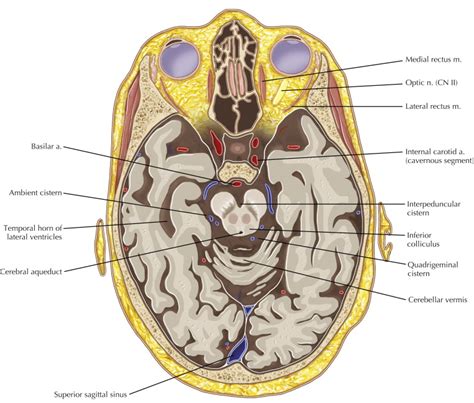 Ventricles and Cerebrospinal Fluid Cisterns | Radiology Key