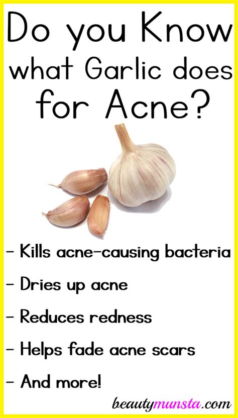 6 Garlic Benefits for Acne - beautymunsta