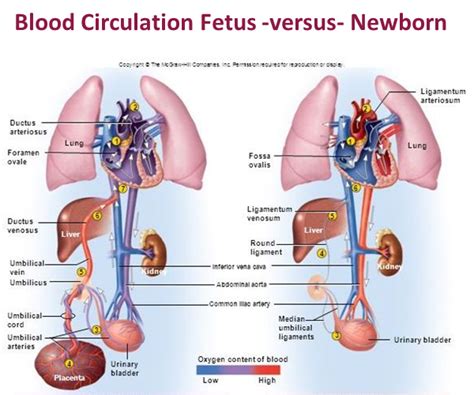 What is umbilical cord milking and when is it done?