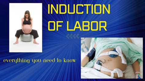 induction of Labour: everything you need to know - YouTube