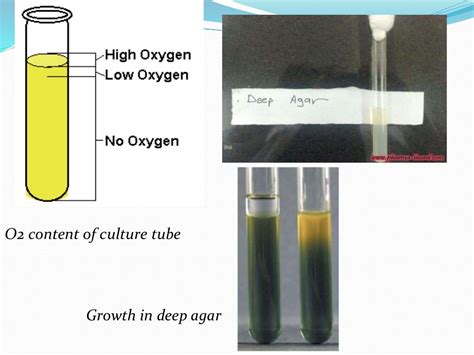 Anaerobic Culture Methods