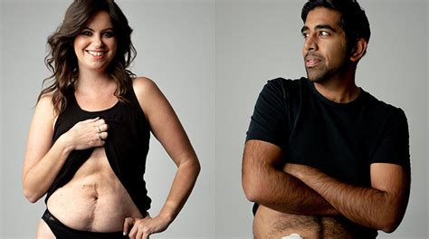 Deborah James Leads Powerful Photo Series Showing Bowel Cancer Doesn't ...