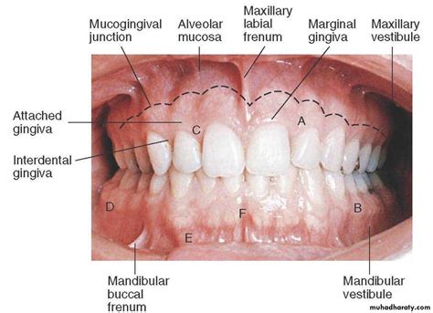 gingiva docx - د.حسين - Muhadharaty