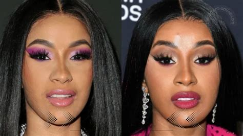 Cardi B Nose Before And After Picture: What Did Cardi B Do To Her Nose?