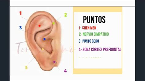 AURICULOTERAPIA Para Ansiedad PUNTOS DE acupuntura para reducir ansiedad y estrés ...