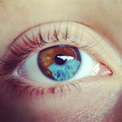 sectoral heterochromia (897×897) | Aesthetic eyes, Different colored ...