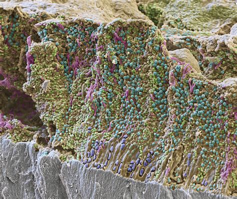 Plaque on tooth, SEM - Stock Image - C045/9722 - Science Photo Library