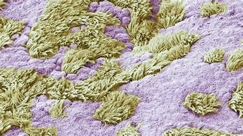 Fimbriae of a fallopian tube, SEM - Stock Video Clip - K005/0380 - Science Photo Library