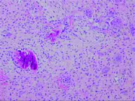 Histopathology, H& E staining | Download Scientific Diagram