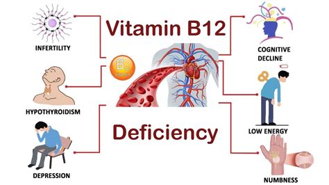 Vitamin B12 Deficiency Treatment In Homeopathy