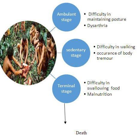 Stages of Kuru Disease. (Source: Google) | Download Scientific Diagram