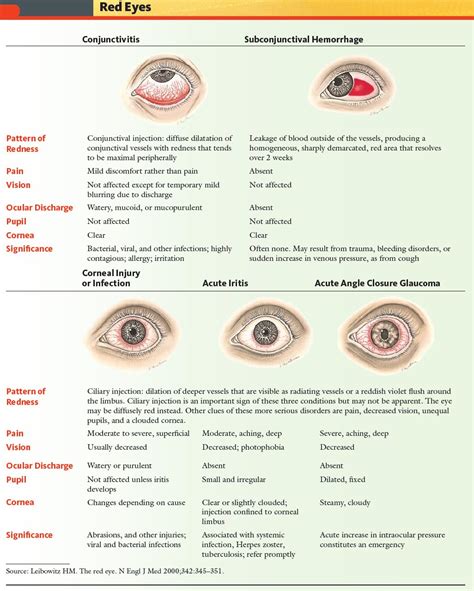 What is Conjunctivitis?