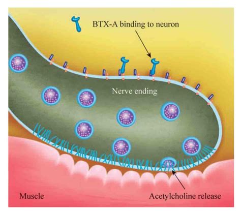 Unit 4: Introduction To Botulinum Toxin & Mechanism Of Action – Vindoc Training