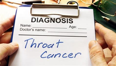 Throat cancer treatment: How it's changing | MD Anderson Cancer Center