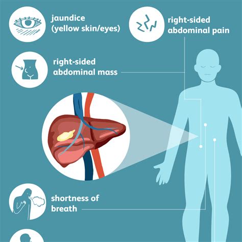 Liver Cancer: Signs, Symptoms, and Complications