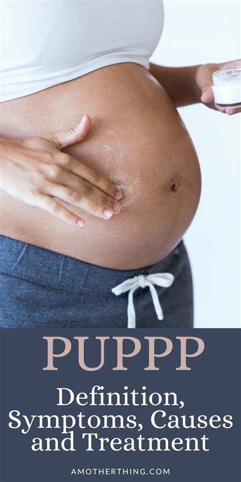 PUPPP Rash: Definition, Symptoms, Causes, & Treatment