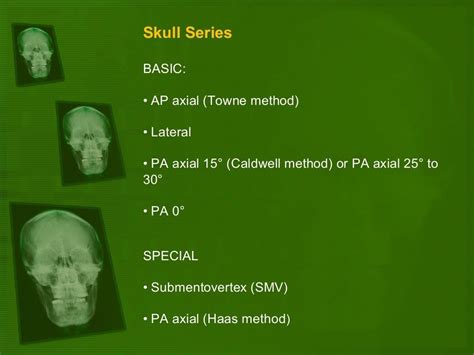 Positioning and radiographic anatomy of the skull X Ray Tube, Rad Tech Week, Sagittal Plane ...