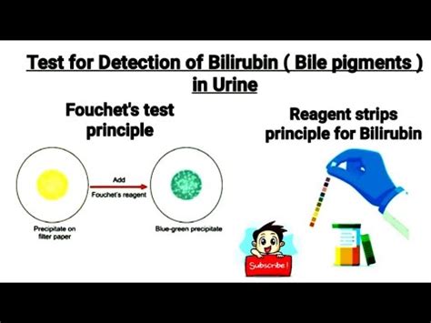 Test for Detection of bilirubin (Bile pigments) in urine || Fouchet's test || what is ...