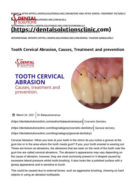 Tooth Cervical Abrasion, Causes, Treatment and prevention - Dental ...