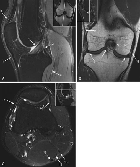 MRI of the Knee - Clinical Tree