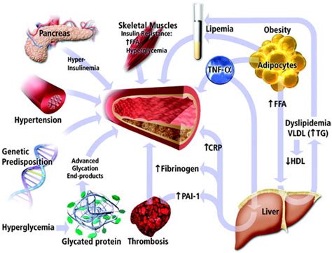 Macrovascular Complications Of Diabetes - DiabetesWalls