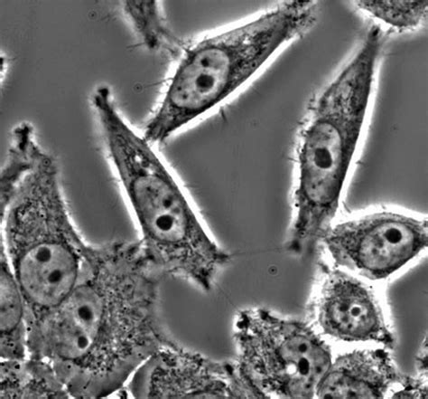 Phase Contrast Microscopes - Upright, Inverted, Microscopy Techniques, Optical Microscopes