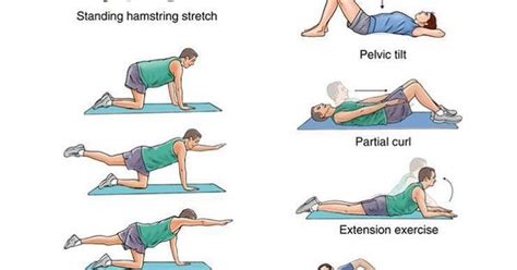 Back pain management | Spinal fusion/nerve damage | Pinterest | Pain management, Management and ...