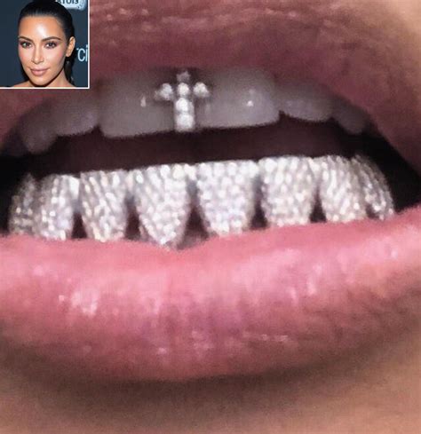 Re: Kanye's new titanium dentures/grill - Page 4 - Blogs & Forums