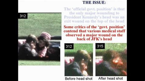 Witness to JFK Head Wound Part VI How Did They Do It? | Doovi